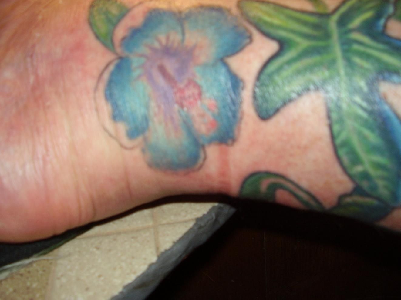 Everything about infected tattoo Causes, Treatments and how to get